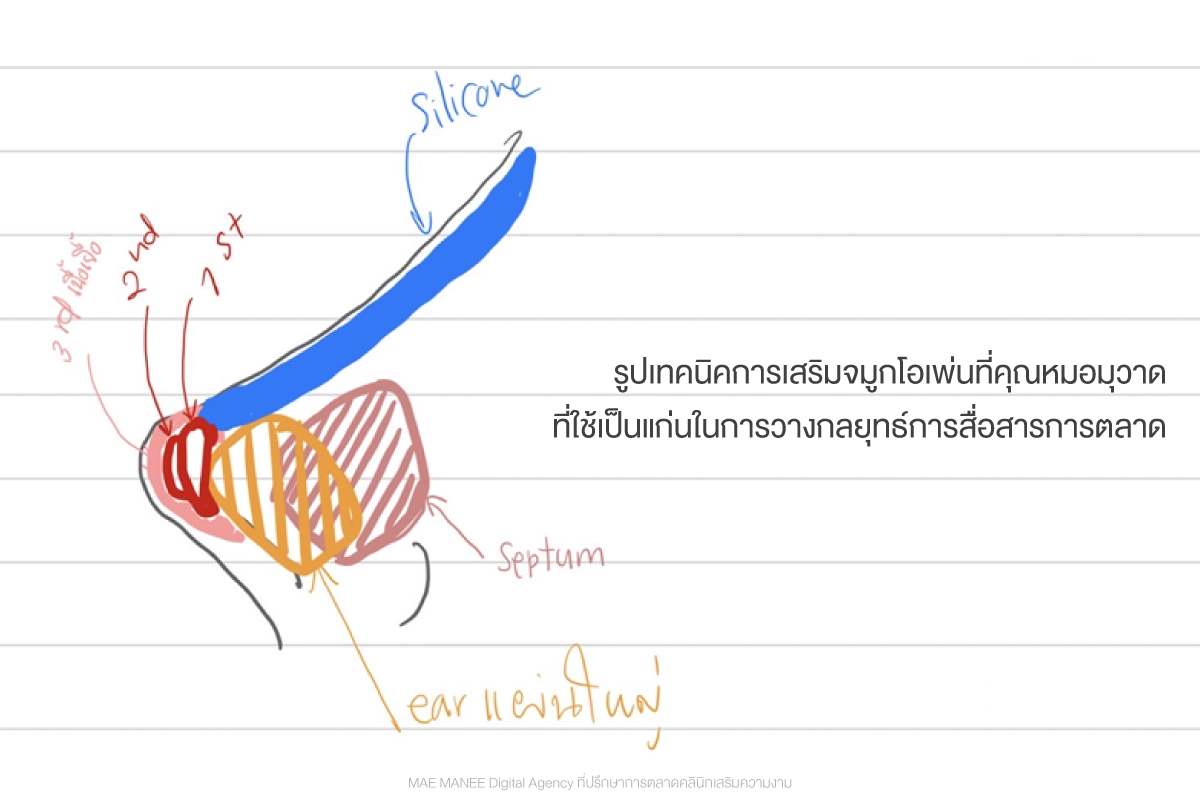 กลยุทธ์การตลาด คลินิกศัลยกรรม